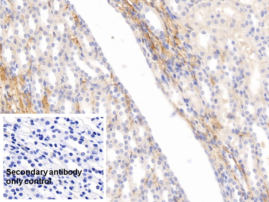 Monoclonal Antibody to Apolipoprotein E (APOE)