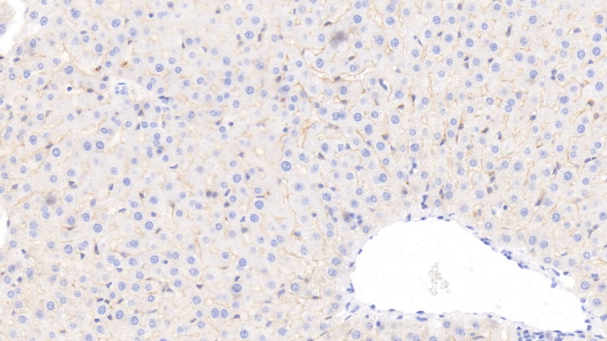 Monoclonal Antibody to Apolipoprotein E (APOE)