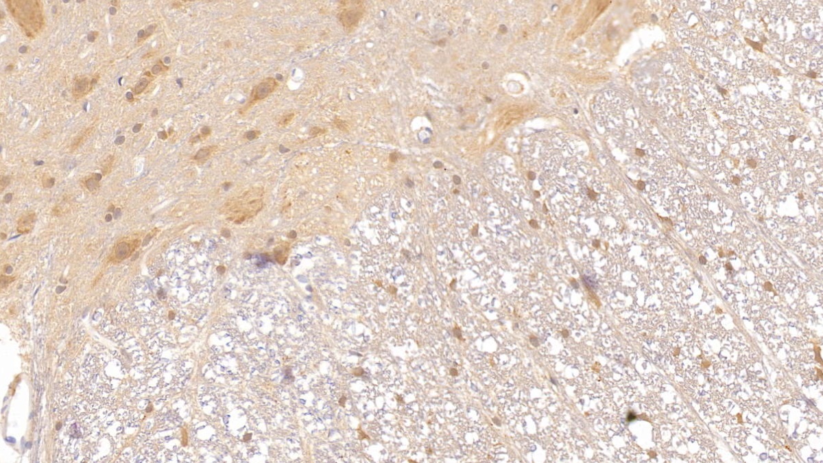 Monoclonal Antibody to Apolipoprotein E (APOE)