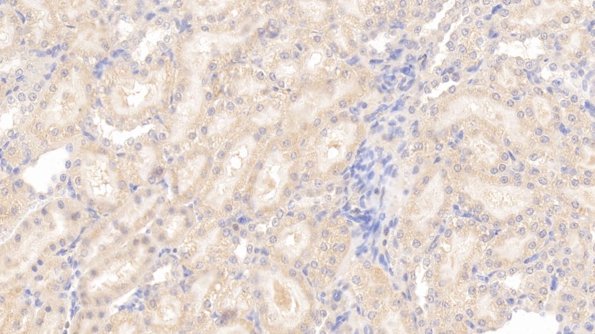 Monoclonal Antibody to Apolipoprotein E (APOE)