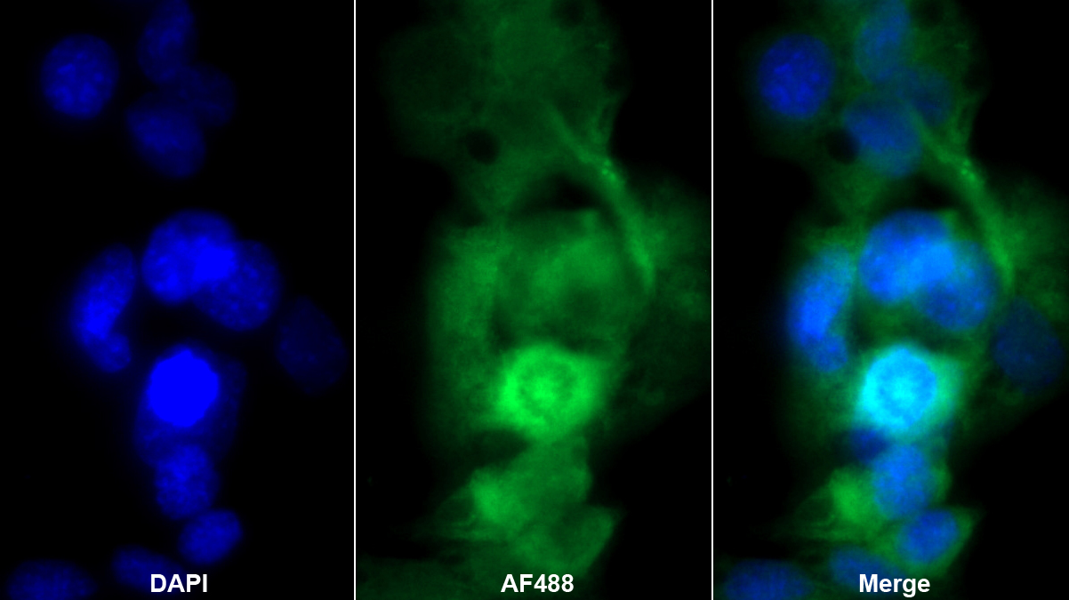 Monoclonal Antibody to Apolipoprotein E (APOE)