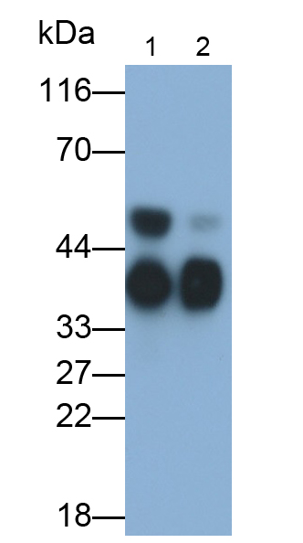 Monoclonal Antibody to Apolipoprotein E (APOE)