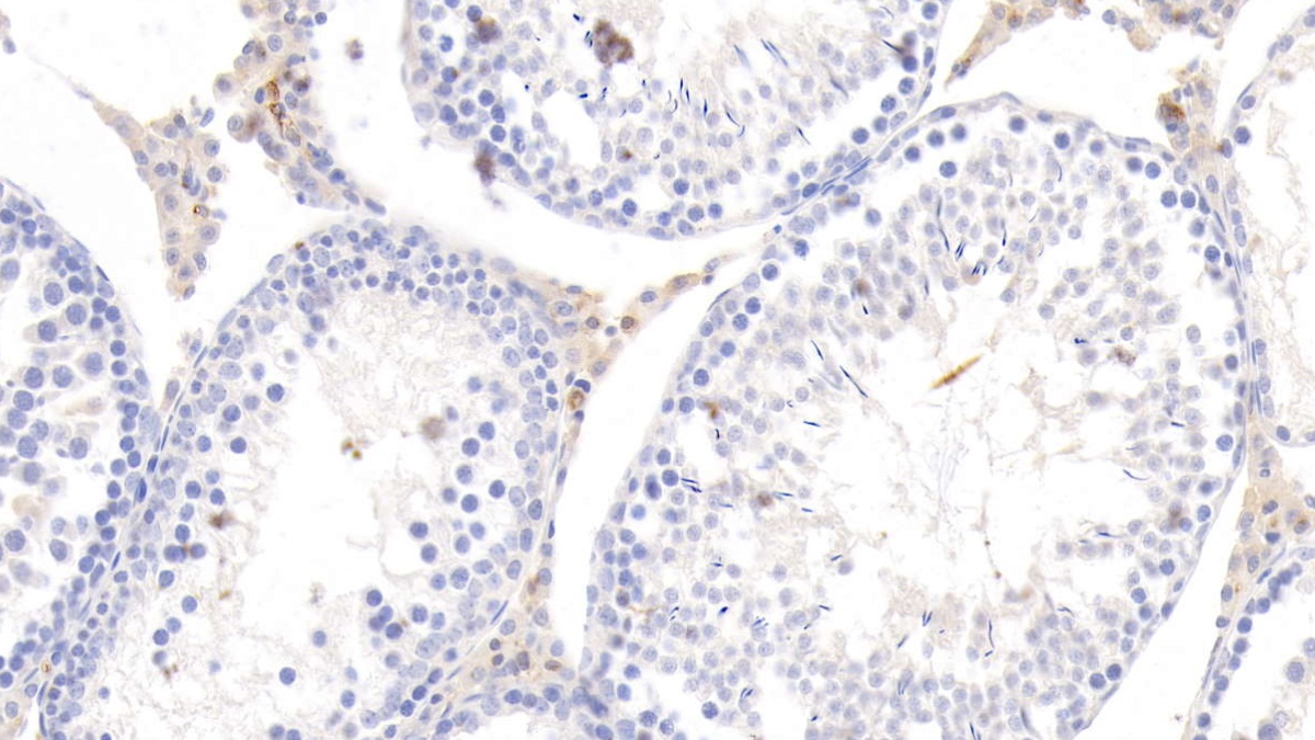 Monoclonal Antibody to Apolipoprotein E (APOE)