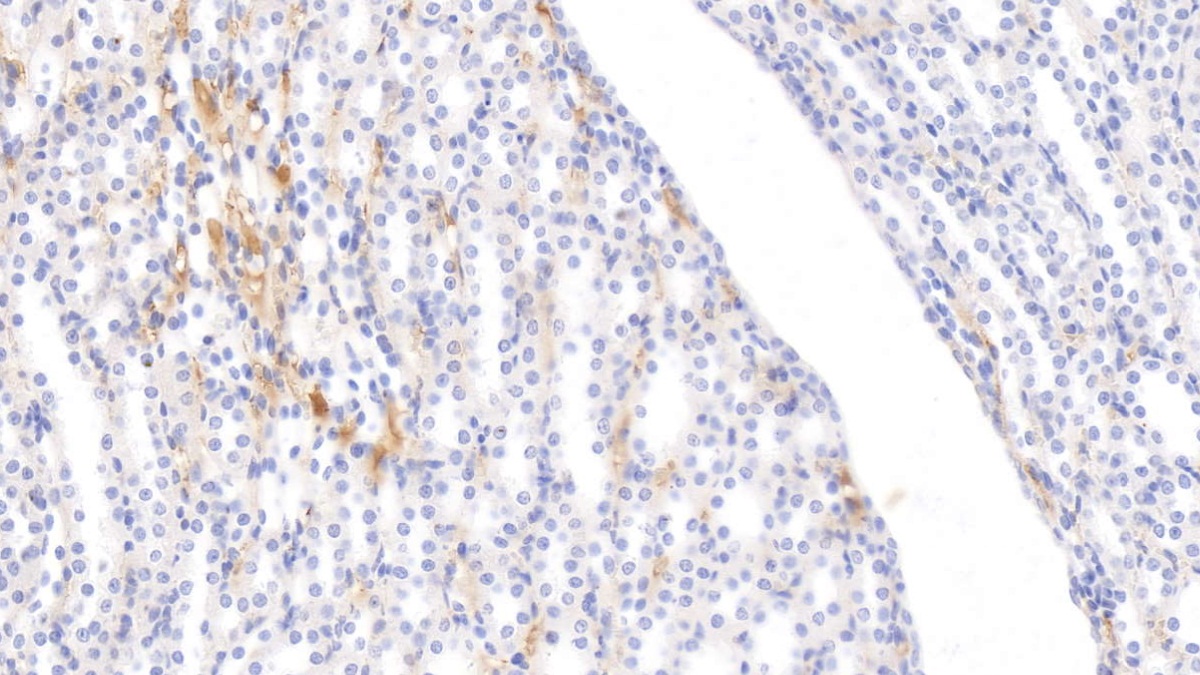 Monoclonal Antibody to Apolipoprotein E (APOE)