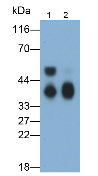 Monoclonal Antibody to Apolipoprotein E (APOE)