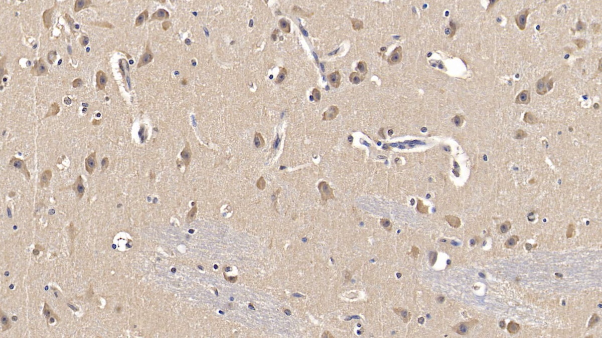 Monoclonal Antibody to Apolipoprotein E (APOE)