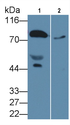 Monoclonal Antibody to Prothrombin Fragment 1+2 (F1+2)