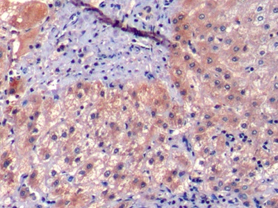 Monoclonal Antibody to Prothrombin Fragment 1+2 (F1+2)