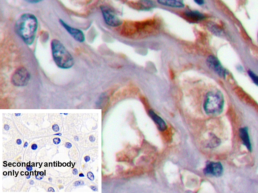 Monoclonal Antibody to Prothrombin Fragment 1+2 (F1+2)