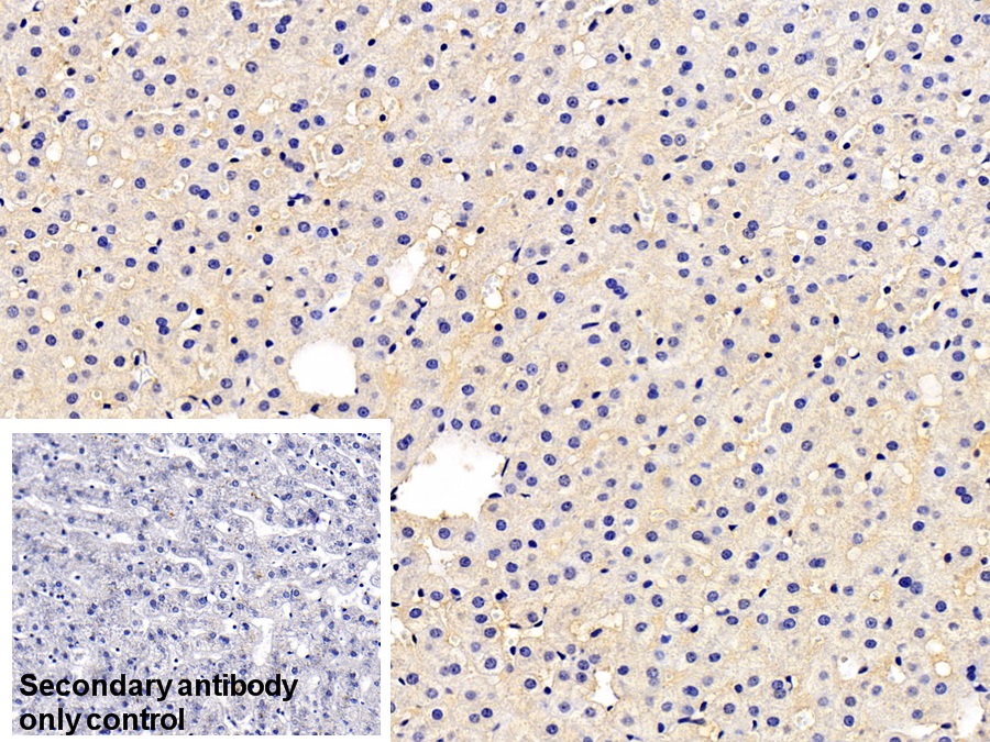 Monoclonal Antibody to Prothrombin Fragment 1+2 (F1+2)