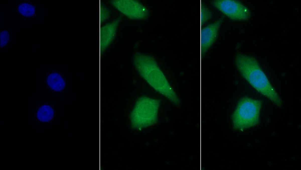 Monoclonal Antibody to Prothrombin Fragment 1+2 (F1+2)