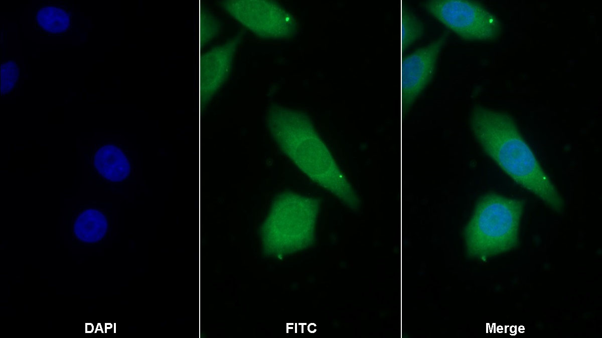 Monoclonal Antibody to Prothrombin Fragment 1+2 (F1+2)