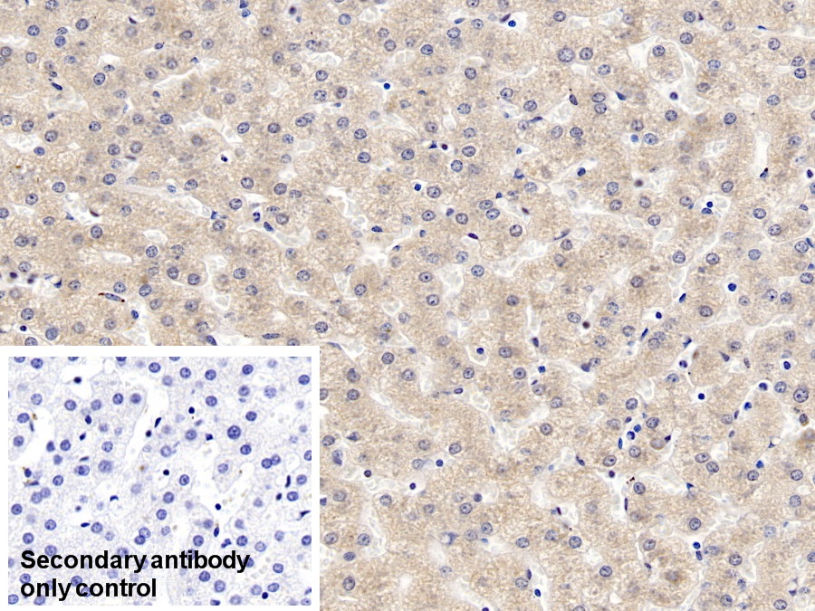 Monoclonal Antibody to Prothrombin Fragment 1+2 (F1+2)