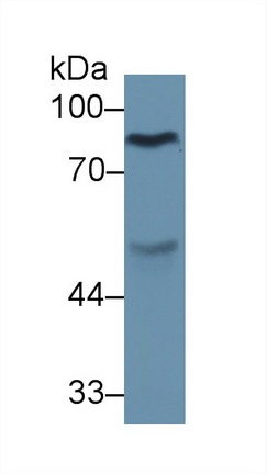 Monoclonal Antibody to Prothrombin Fragment 1+2 (F1+2)