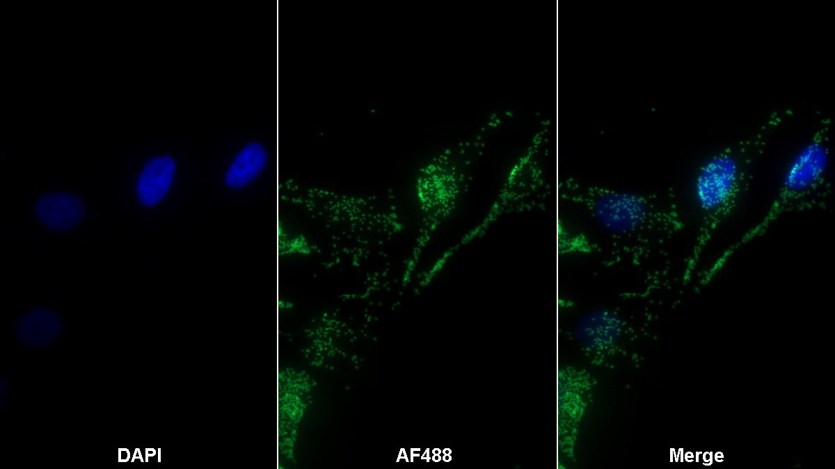 Monoclonal Antibody to Prothrombin Fragment 1+2 (F1+2)