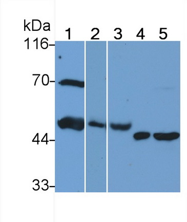 Monoclonal Antibody to Heparanase (HPSE)