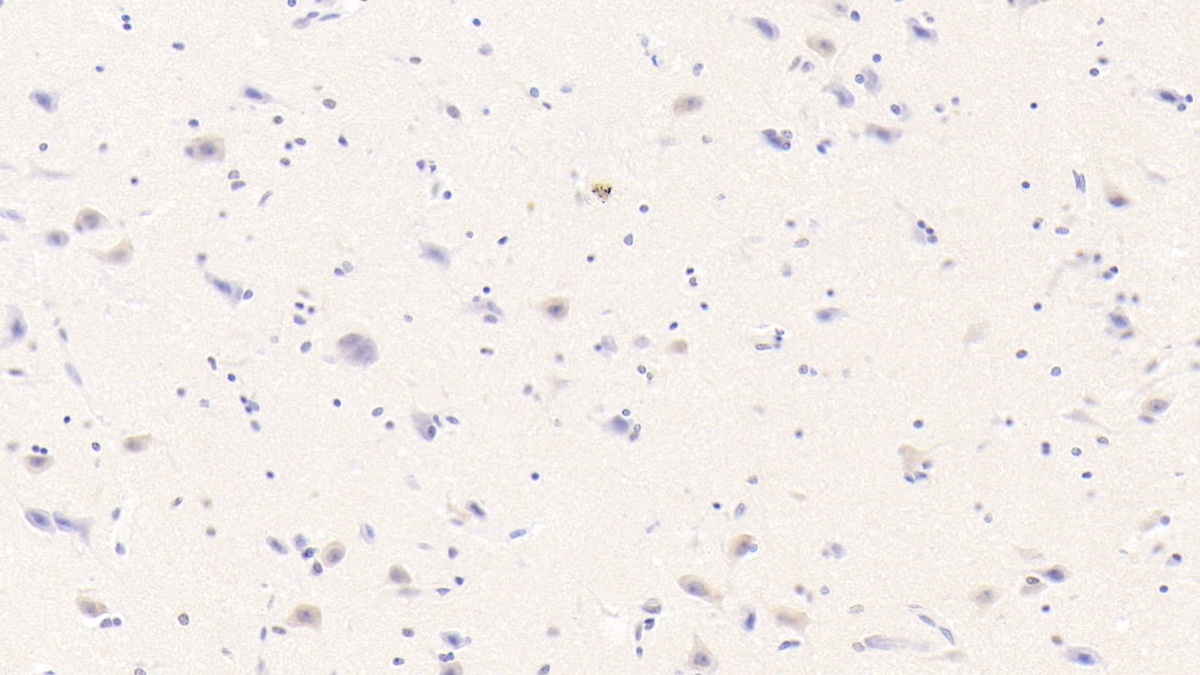 Monoclonal Antibody to Beta-Site APP Cleaving Enzyme 1 (bACE1)