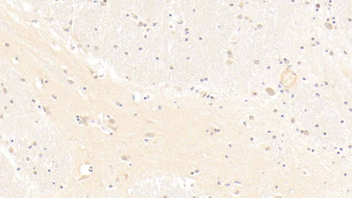 Monoclonal Antibody to Beta-Site APP Cleaving Enzyme 1 (bACE1)