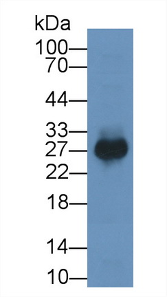 Monoclonal Antibody to Prostaglandin-H2 D-isomerase (PTGDS)