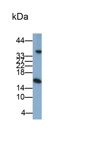 Monoclonal Antibody to Prealbumin (PALB)