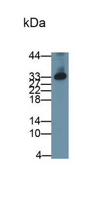 Monoclonal Antibody to Dickkopf Related Protein 1 (DKK1)