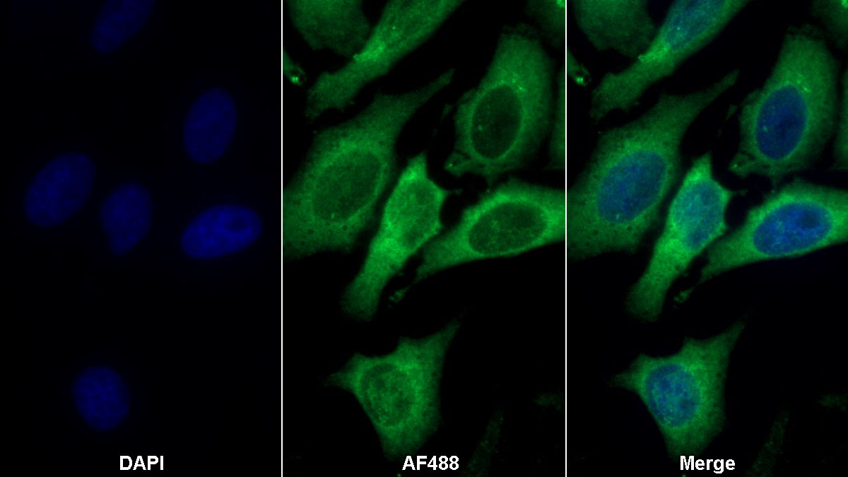 Monoclonal Antibody to Dickkopf Related Protein 1 (DKK1)