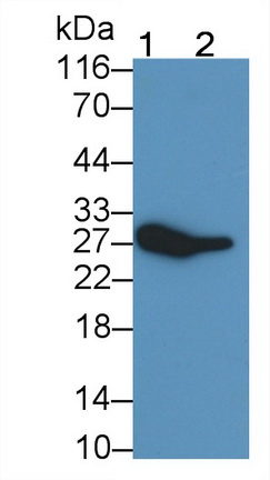 Monoclonal Antibody to Programmed Cell Death Protein 1 (PD1)