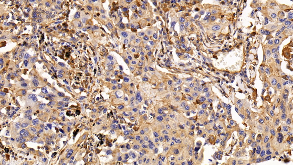 Monoclonal Antibody to Epidermal Growth Factor Receptor (EGFR)