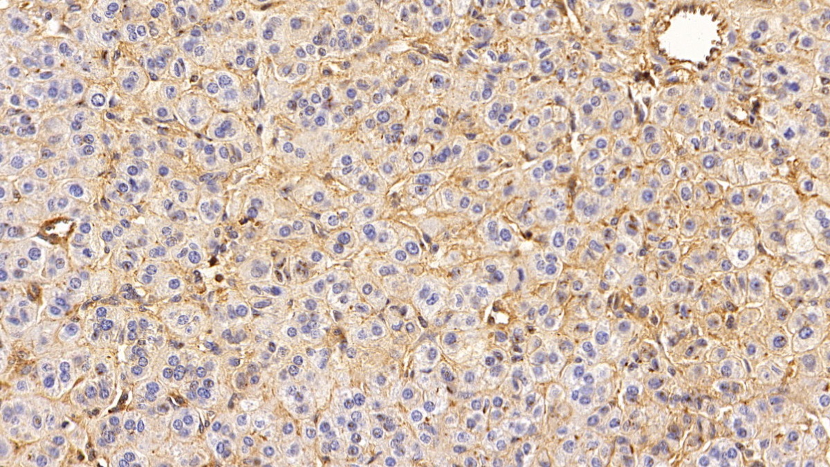 Monoclonal Antibody to Epidermal Growth Factor Receptor (EGFR)