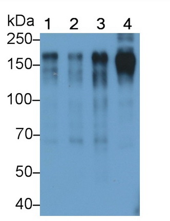 Monoclonal Antibody to Epidermal Growth Factor Receptor (EGFR)