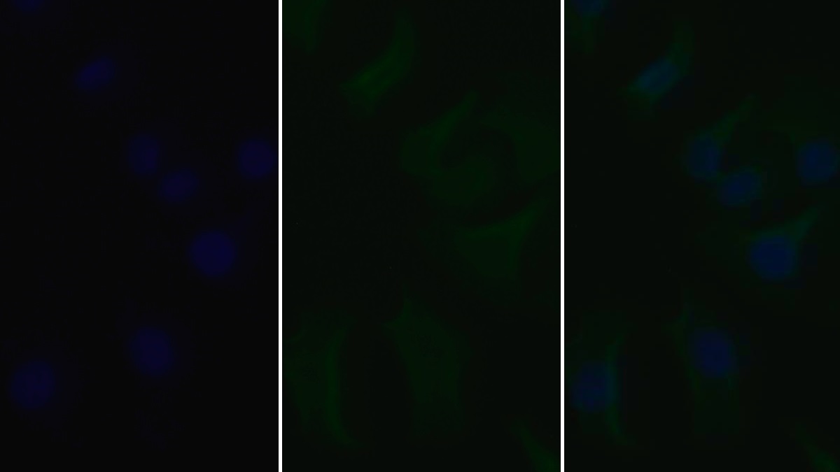 Monoclonal Antibody to Epidermal Growth Factor Receptor (EGFR)