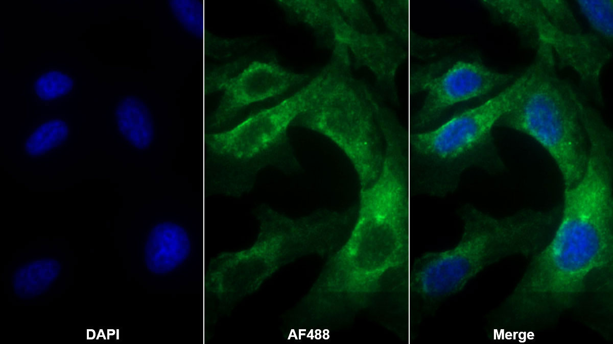 Monoclonal Antibody to Epidermal Growth Factor Receptor (EGFR)