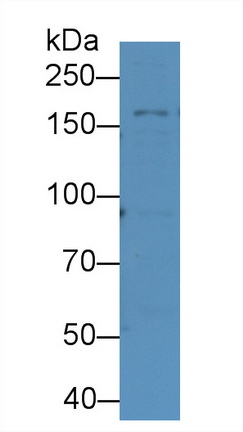 Monoclonal Antibody to Complement C3 Convertase (C3 Convertase)