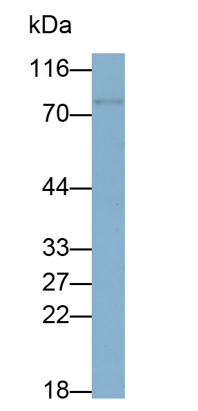 Monoclonal Antibody to Forkhead Box Protein P1 (FOXP1)