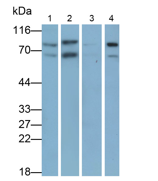 Monoclonal Antibody to Forkhead Box Protein P1 (FOXP1)