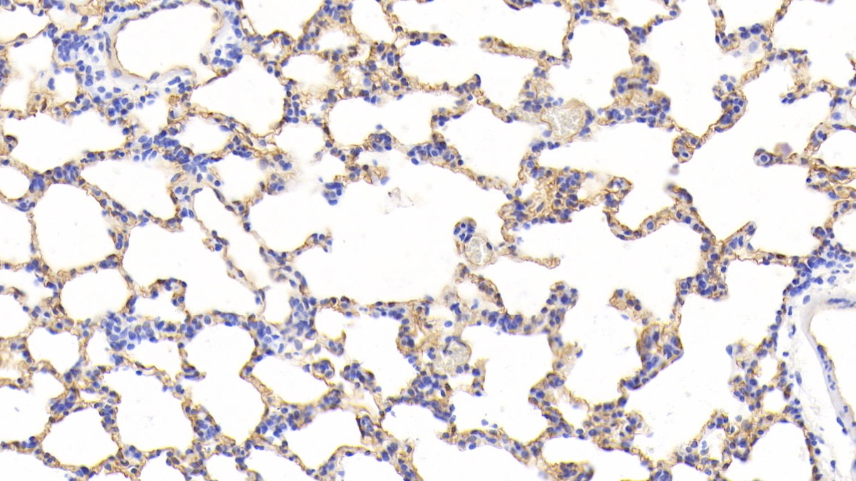 Monoclonal Antibody to Podocalyxin (PODXL)