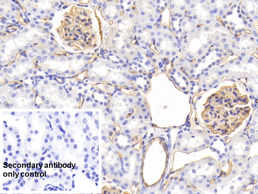 Monoclonal Antibody to Podocalyxin (PODXL)