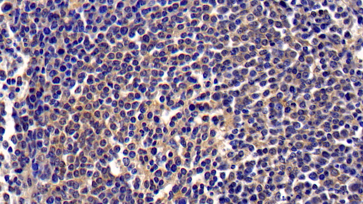 Monoclonal Antibody to Chemokine C-X-C-Motif Ligand 16 (CXCL16)