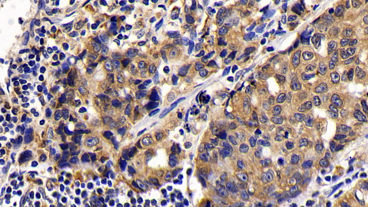 Monoclonal Antibody to B-Cell Leukemia/Lymphoma 2 (Bcl2)