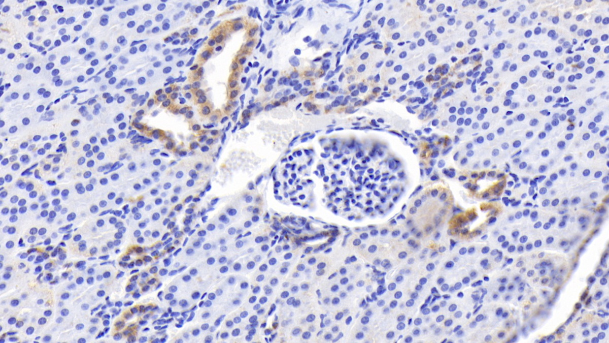 Monoclonal Antibody to B-Cell Leukemia/Lymphoma 2 (Bcl2)