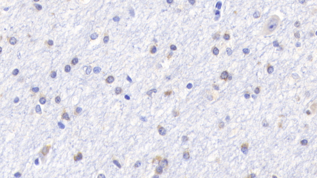 Monoclonal Antibody to B-Cell Leukemia/Lymphoma 2 (Bcl2)