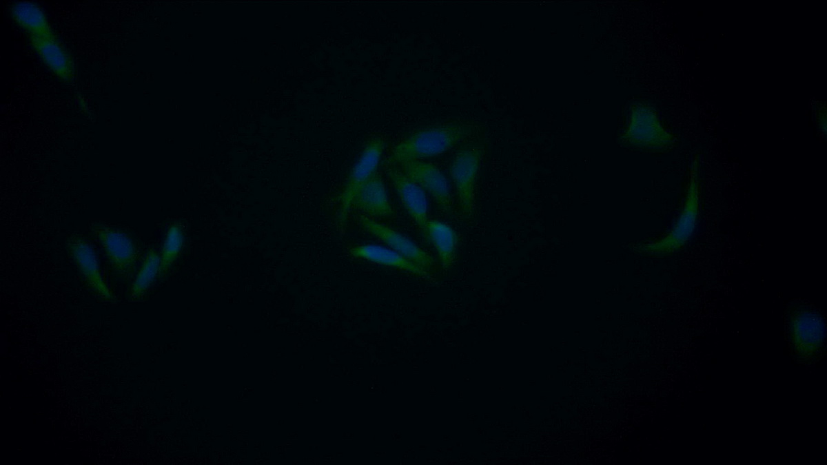 Monoclonal Antibody to B-Cell Leukemia/Lymphoma 2 (Bcl2)