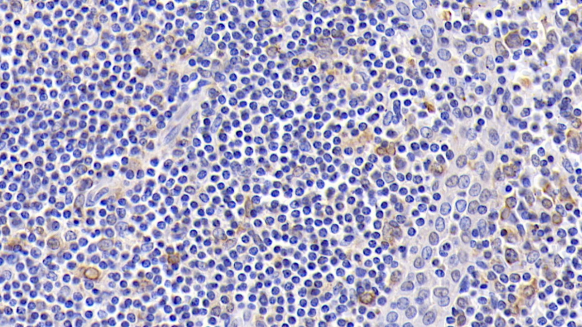 Monoclonal Antibody to B-Cell Leukemia/Lymphoma 2 (Bcl2)