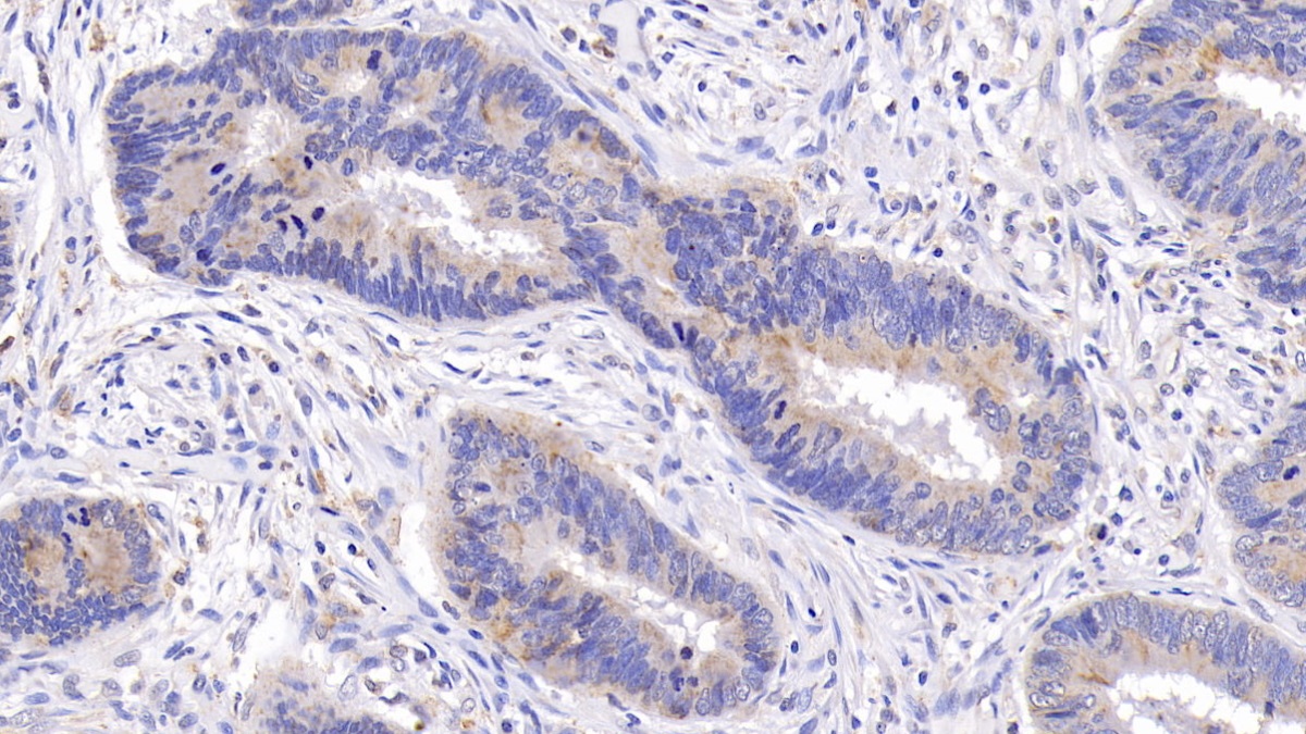 Monoclonal Antibody to B-Cell Leukemia/Lymphoma 2 (Bcl2)