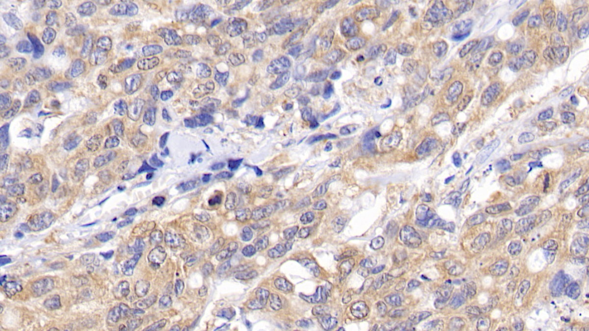 Monoclonal Antibody to B-Cell Leukemia/Lymphoma 2 (Bcl2)