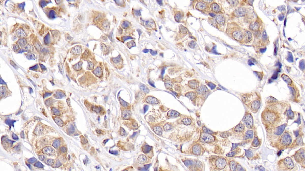 Monoclonal Antibody to B-Cell Leukemia/Lymphoma 2 (Bcl2)