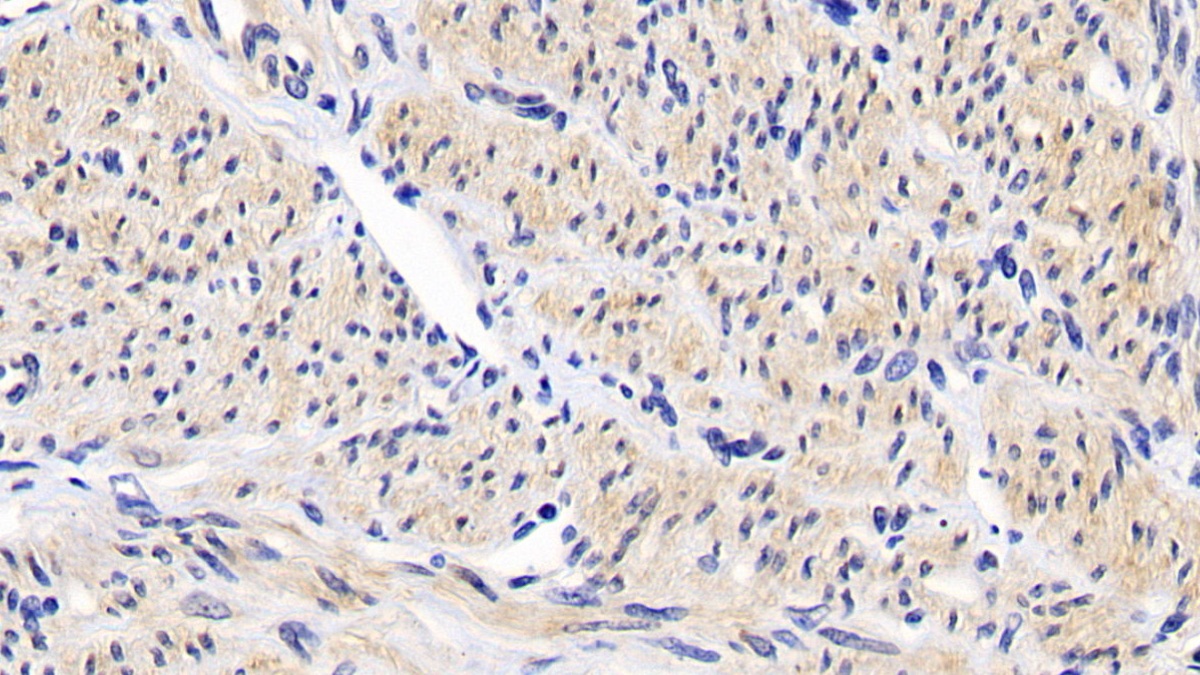 Monoclonal Antibody to B-Cell Leukemia/Lymphoma 2 (Bcl2)