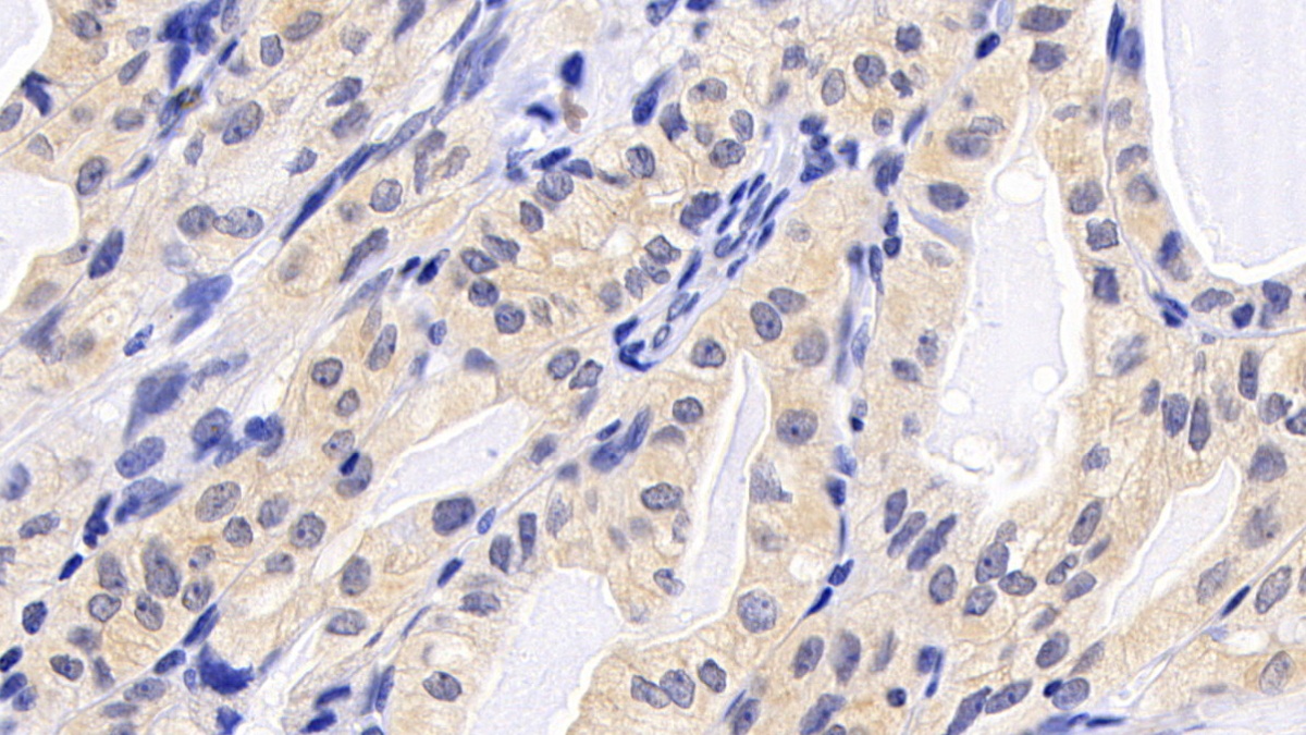 Monoclonal Antibody to B-Cell Leukemia/Lymphoma 2 (Bcl2)