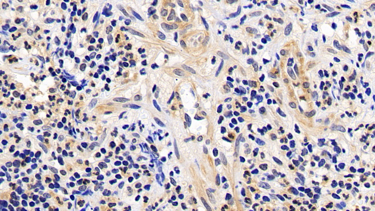 Monoclonal Antibody to B-Cell Leukemia/Lymphoma 2 (Bcl2)