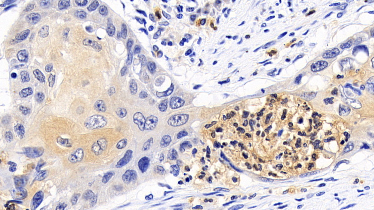 Monoclonal Antibody to B-Cell Leukemia/Lymphoma 2 (Bcl2)